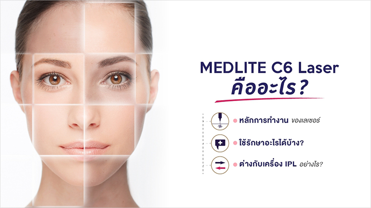 เลเซอร์ MedLite C 6 Laser คืออะไร?